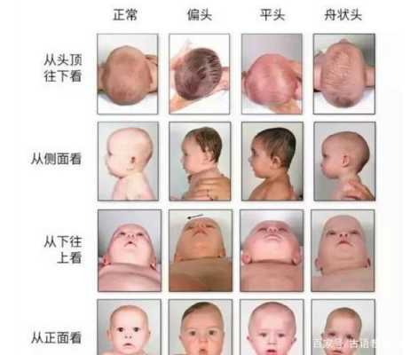 为什么胎儿头会偏大(婴儿头偏大,什么原因) 第2张 为什么胎儿头会偏大(婴儿头偏大,什么原因) 第2张