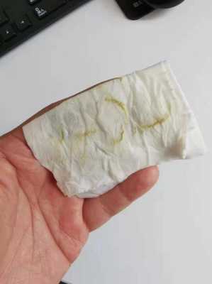 怀孕初期有黄色分泌物是什么原因,怀孕期间流黄色分泌物正常吗 第2张 怀孕初期有黄色分泌物是什么原因,怀孕期间流黄色分泌物正常吗 第2张