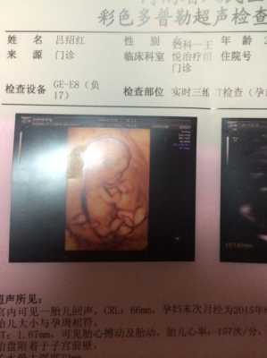 五个月宝宝最大可以听多大声,胎儿能听见多大的声音 第3张 五个月宝宝最大可以听多大声,胎儿能听见多大的声音 第3张