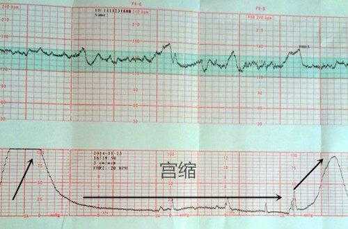 怀孕34周胎心160正常吗,胎儿心脏看不清的原因有哪些 第1张 怀孕34周胎心160正常吗,胎儿心脏看不清的原因有哪些 第1张