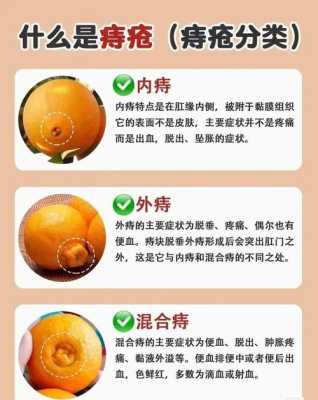 怀孕期间有痔疮怎么治(孕期得痔疮怎么治疗呢) 第3张 怀孕期间有痔疮怎么治(孕期得痔疮怎么治疗呢) 第3张