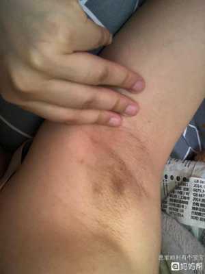 怀孕期间长的副乳图片(怀孕期间长的副乳图片) 第3张 怀孕期间长的副乳图片(怀孕期间长的副乳图片) 第3张