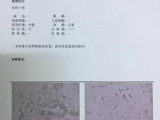 孕期白带清洁度4怎么办(孕晚期白带化验出清洁度4,该怎么治疗) 第2张 孕期白带清洁度4怎么办(孕晚期白带化验出清洁度4,该怎么治疗) 第2张