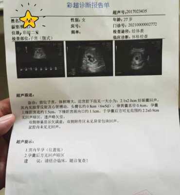 一位孕妈的孕期日记(一位孕妈的孕期日记怎么写) 第1张 一位孕妈的孕期日记(一位孕妈的孕期日记怎么写) 第1张