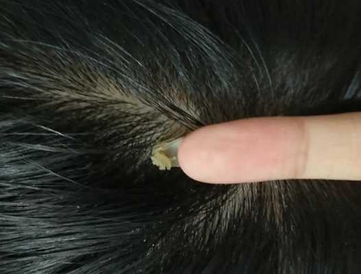 怀孕期间流黑色分泌物(怀孕期间流黑色分泌物是什么原因引起的) 第1张 怀孕期间流黑色分泌物(怀孕期间流黑色分泌物是什么原因引起的) 第1张