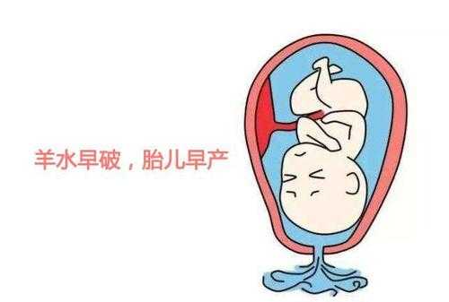 羊水破了对胎儿有什么影响(羊水破了对胎儿有什么影响没) 第2张 羊水破了对胎儿有什么影响(羊水破了对胎儿有什么影响没) 第2张
