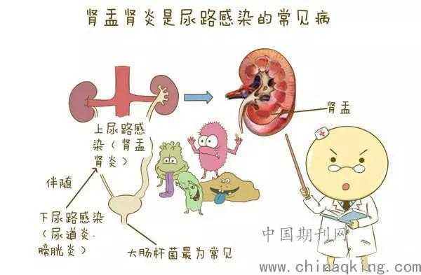 备孕期间尿道炎怎么办(尿路感染会影响怀孕吗) 第2张 备孕期间尿道炎怎么办(尿路感染会影响怀孕吗) 第2张