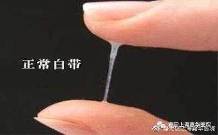 孕期内分泌多怎么回事(孕妇白带多怎么回事) 第1张 孕期内分泌多怎么回事(孕妇白带多怎么回事) 第1张