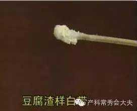 怀孕期分泌物多怎么办(孕妇白带多正常吗) 第2张 怀孕期分泌物多怎么办(孕妇白带多正常吗) 第2张