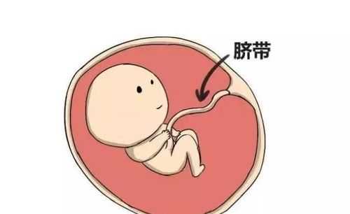 胎儿脐带短是什么原因(胎儿脐带短是什么原因造成的) 第1张 胎儿脐带短是什么原因(胎儿脐带短是什么原因造成的) 第1张