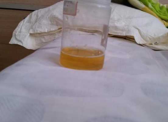 怀孕期间脸色发黄是什么原因（孕期尿黄是怎么回事）  第2张