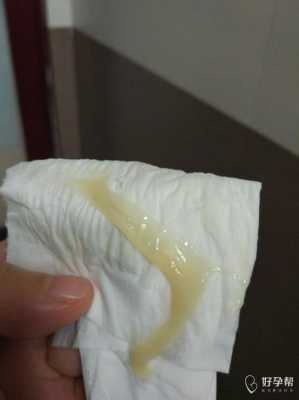 怀孕后的白带是什么样子的, 第1张 怀孕后的白带是什么样子的, 第1张