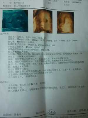 孕妇做四维彩超24周胎儿显示没有胆囊,胎儿没胆囊问题大不大 第1张 孕妇做四维彩超24周胎儿显示没有胆囊,胎儿没胆囊问题大不大 第1张