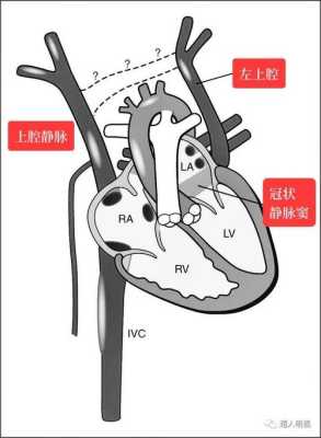 胎儿永存左上腔静脉严重吗(胎儿永存左上腔静脉严重吗会怎么样) 第2张 胎儿永存左上腔静脉严重吗(胎儿永存左上腔静脉严重吗会怎么样) 第2张