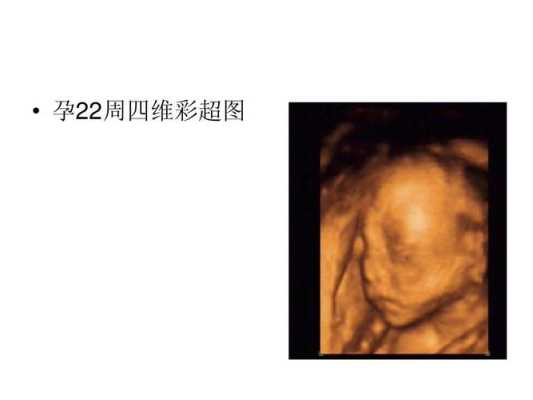 孕22周胎儿在什么位置(孕22周胎儿心率163-146,很不好吗) 第2张 孕22周胎儿在什么位置(孕22周胎儿心率163-146,很不好吗) 第2张