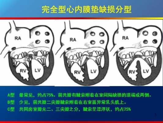 胎儿发育有的心脏为什么会发育不好,胎儿心内膜垫缺损原因有哪些 第1张 胎儿发育有的心脏为什么会发育不好,胎儿心内膜垫缺损原因有哪些 第1张