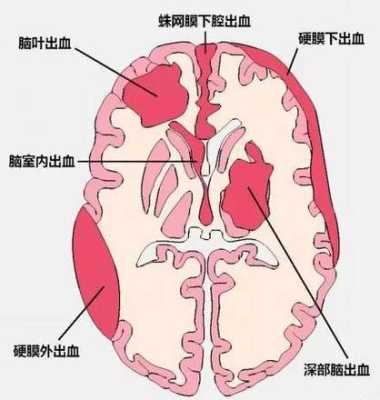 什么是第五第六脑室形成,胎儿第六脑室形成有什么危害 第2张 什么是第五第六脑室形成,胎儿第六脑室形成有什么危害 第2张