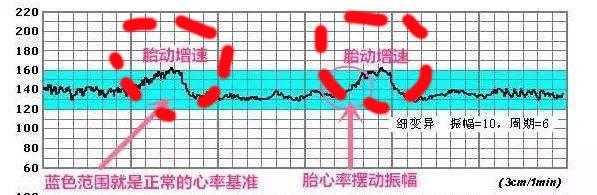胎心监护胎儿动的厉害(胎心监护胎儿动的厉害胎心率快) 第1张 胎心监护胎儿动的厉害(胎心监护胎儿动的厉害胎心率快) 第1张