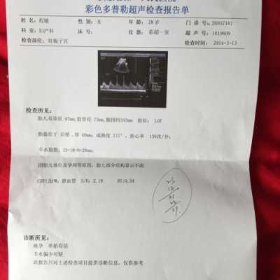孕38周肚子痛没有见红,38周胎儿发育好了吗正常吗 第2张 孕38周肚子痛没有见红,38周胎儿发育好了吗正常吗 第2张