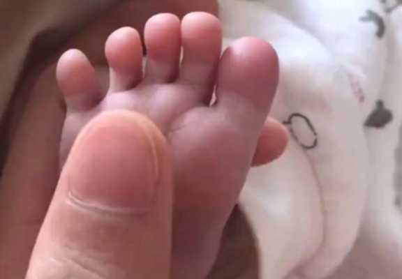 胎儿为什么会手掌缺如(宝宝手心脚心发烫是咋回事) 第1张 胎儿为什么会手掌缺如(宝宝手心脚心发烫是咋回事) 第1张