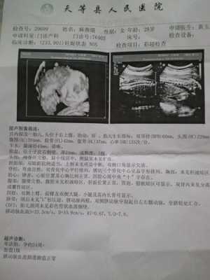 怀孕二十九周胎儿图(怀孕29周胎儿各项指标多少) 第3张 怀孕二十九周胎儿图(怀孕29周胎儿各项指标多少) 第3张