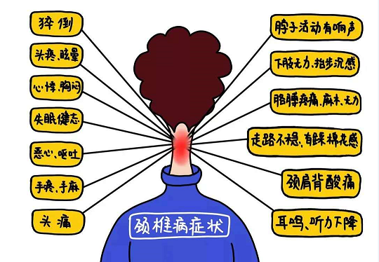 孕期颈椎(孕期颈椎疼痛难忍怎么办) 第2张 孕期颈椎(孕期颈椎疼痛难忍怎么办) 第2张