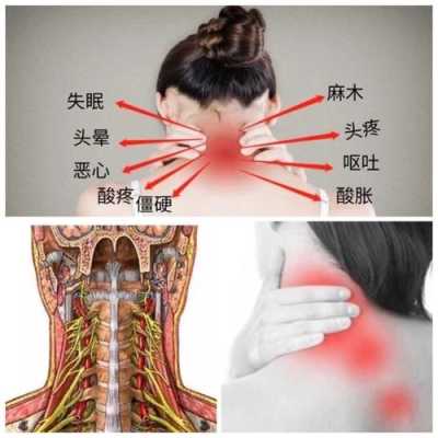 孕期颈椎(孕期颈椎疼痛难忍怎么办) 第1张 孕期颈椎(孕期颈椎疼痛难忍怎么办) 第1张