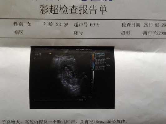 怀孕19周做2维彩超说胎儿胃泡显示不清。怎么办,胎儿胃泡小要注意哪些事项 第2张 怀孕19周做2维彩超说胎儿胃泡显示不清。怎么办,胎儿胃泡小要注意哪些事项 第2张
