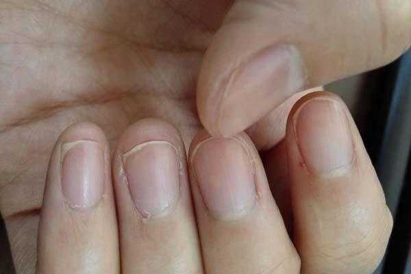 孕期指甲(孕期指甲长得快是什么原因) 第2张 孕期指甲(孕期指甲长得快是什么原因) 第2张
