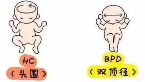 宝宝双顶径太大是不是因为吃了DHA啊,胎儿双顶径偏大的原因有哪些? 第2张 宝宝双顶径太大是不是因为吃了DHA啊,胎儿双顶径偏大的原因有哪些? 第2张