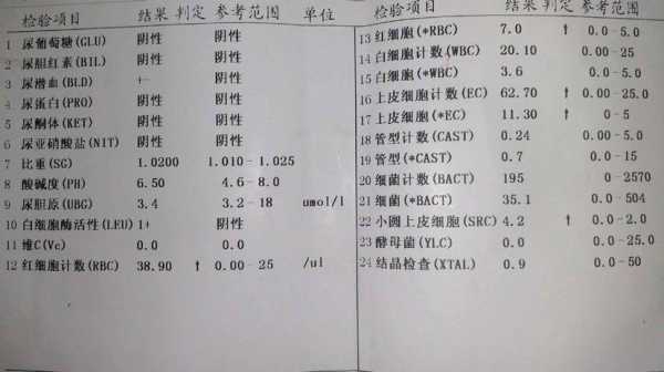 孕期尿液检查(公安尿检是什么意思) 第3张 孕期尿液检查(公安尿检是什么意思) 第3张