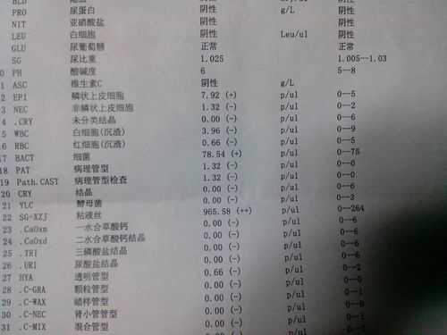孕期尿液检查(公安尿检是什么意思) 第2张 孕期尿液检查(公安尿检是什么意思) 第2张