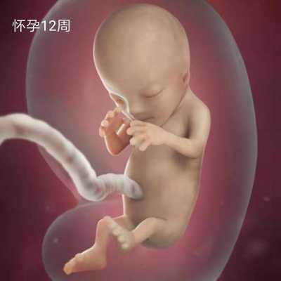 医生说胎儿头大怎么办(怀孕11周,胎儿头臀长48正常吗) 第2张 医生说胎儿头大怎么办(怀孕11周,胎儿头臀长48正常吗) 第2张