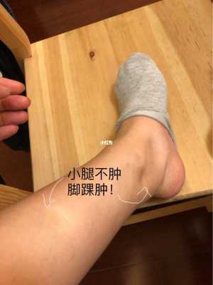 孕期腿脚浮肿(孕妇脚水肿怎么办) 第2张 孕期腿脚浮肿(孕妇脚水肿怎么办) 第2张