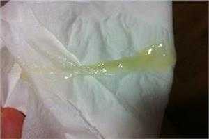 孕期白色白带(孕期白色的分泌物是什么) 第1张 孕期白色白带(孕期白色的分泌物是什么) 第1张