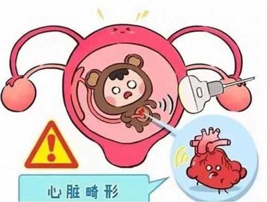 胎儿有心脏病的症状（胎儿有心脏病的症状有哪些）  第2张