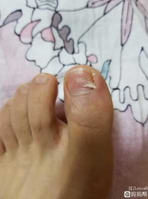孕期指甲空了（脚指甲空了是怎么回事）  第3张