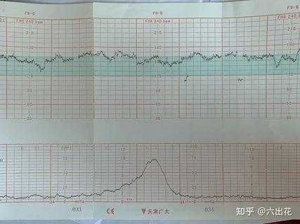 胎儿心率偏快怎么办(做胎心监护宝宝老动一动心率就快正常么) 第2张 胎儿心率偏快怎么办(做胎心监护宝宝老动一动心率就快正常么) 第2张