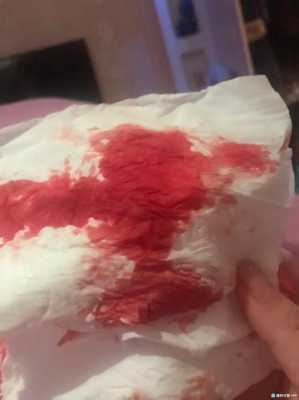 孕期出血鲜红(怀孕初期流黑红色的血是怎么回事) 第2张 孕期出血鲜红(怀孕初期流黑红色的血是怎么回事) 第2张