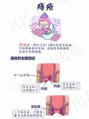 孕期长痔疮(孕期长痔疮怎么办 有肉球) 第1张 孕期长痔疮(孕期长痔疮怎么办 有肉球) 第1张