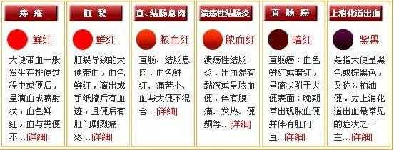 孕期大便便血(孕期大便出血是什么原因?孕期大便出血是长痔疮吗) 第1张 孕期大便便血(孕期大便出血是什么原因?孕期大便出血是长痔疮吗) 第1张