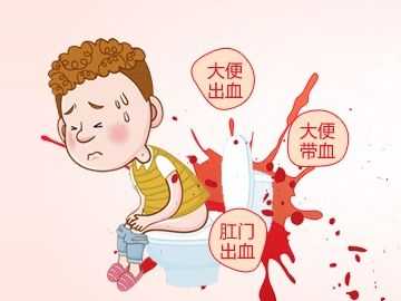 孕期大便便血(孕期大便出血是什么原因?孕期大便出血是长痔疮吗) 第3张 孕期大便便血(孕期大便出血是什么原因?孕期大便出血是长痔疮吗) 第3张