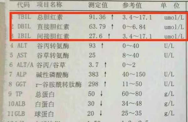 孕期胆红素高(孕期胆红素高是怎么回事有什么危害) 第2张 孕期胆红素高(孕期胆红素高是怎么回事有什么危害) 第2张