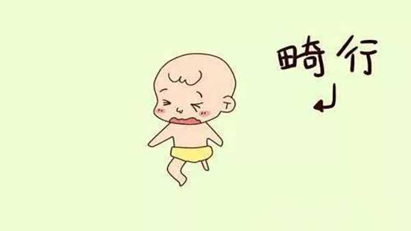 一般胎儿畸形几率大吗(一般胎儿畸形几率大吗知乎) 第1张 一般胎儿畸形几率大吗(一般胎儿畸形几率大吗知乎) 第1张