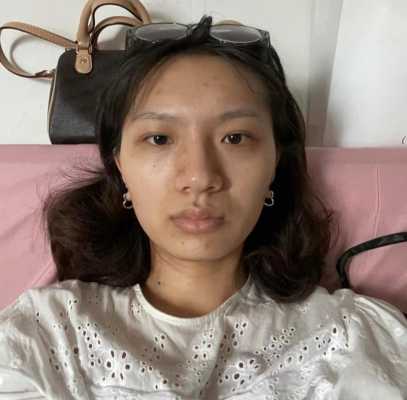 孕期皮肤发黄(孕期皮肤发黄正常吗) 第2张 孕期皮肤发黄(孕期皮肤发黄正常吗) 第2张
