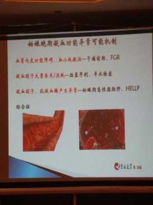 孕期查凝血（孕晚期凝血有什么危害）  第1张