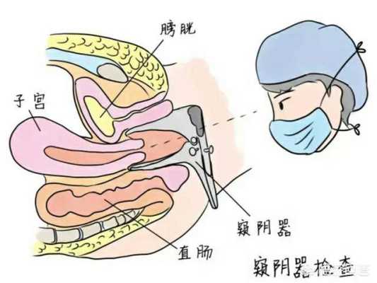 外阴痒,白带常规检查正常,TCT,hpv也正常那是什么原因呢,孕期检查正常胎儿出生就一定正常吗 第2张 外阴痒,白带常规检查正常,TCT,hpv也正常那是什么原因呢,孕期检查正常胎儿出生就一定正常吗 第2张