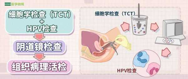 外阴痒,白带常规检查正常,TCT,hpv也正常那是什么原因呢,孕期检查正常胎儿出生就一定正常吗 第1张 外阴痒,白带常规检查正常,TCT,hpv也正常那是什么原因呢,孕期检查正常胎儿出生就一定正常吗 第1张