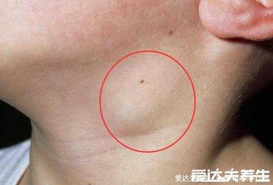 孕期腋下淋巴(孕期腋下淋巴结肿大正常吗) 第3张 孕期腋下淋巴(孕期腋下淋巴结肿大正常吗) 第3张