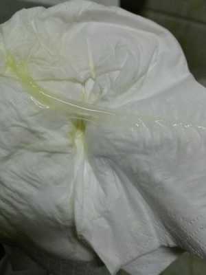 孕期白带深黄(孕期白带发黄是怎么回事) 第2张 孕期白带深黄(孕期白带发黄是怎么回事) 第2张